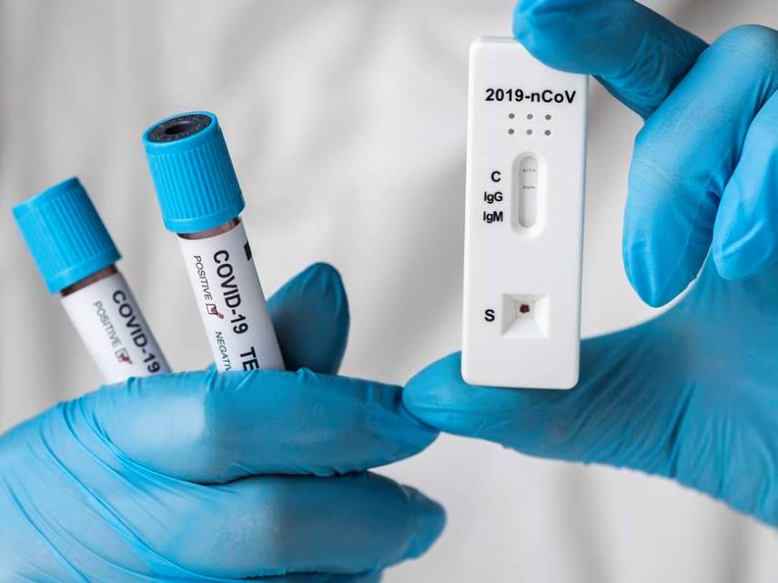 xét nghiệm SARS-CoV-2 bằng phương pháp RT-PCR